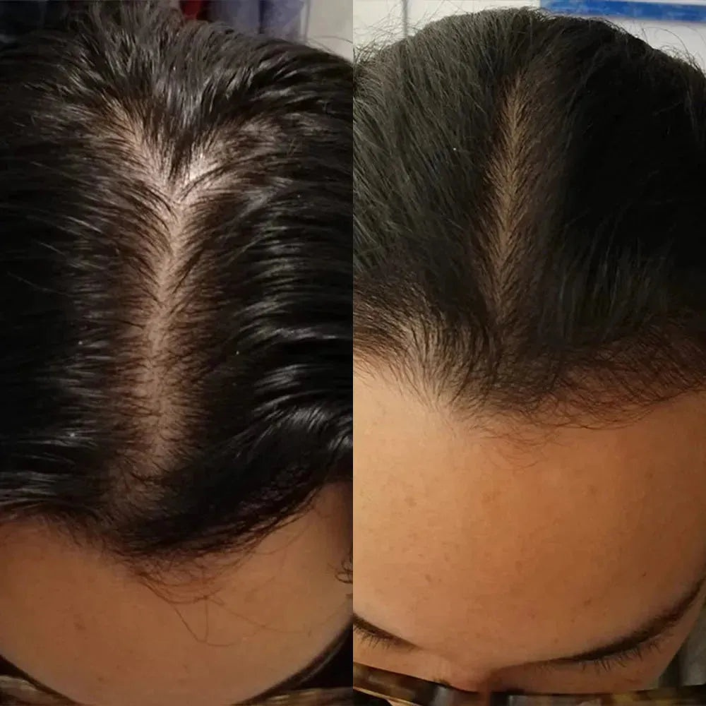 Scandinavian Biolabs Bio-Pilixin serum (vrouw)
